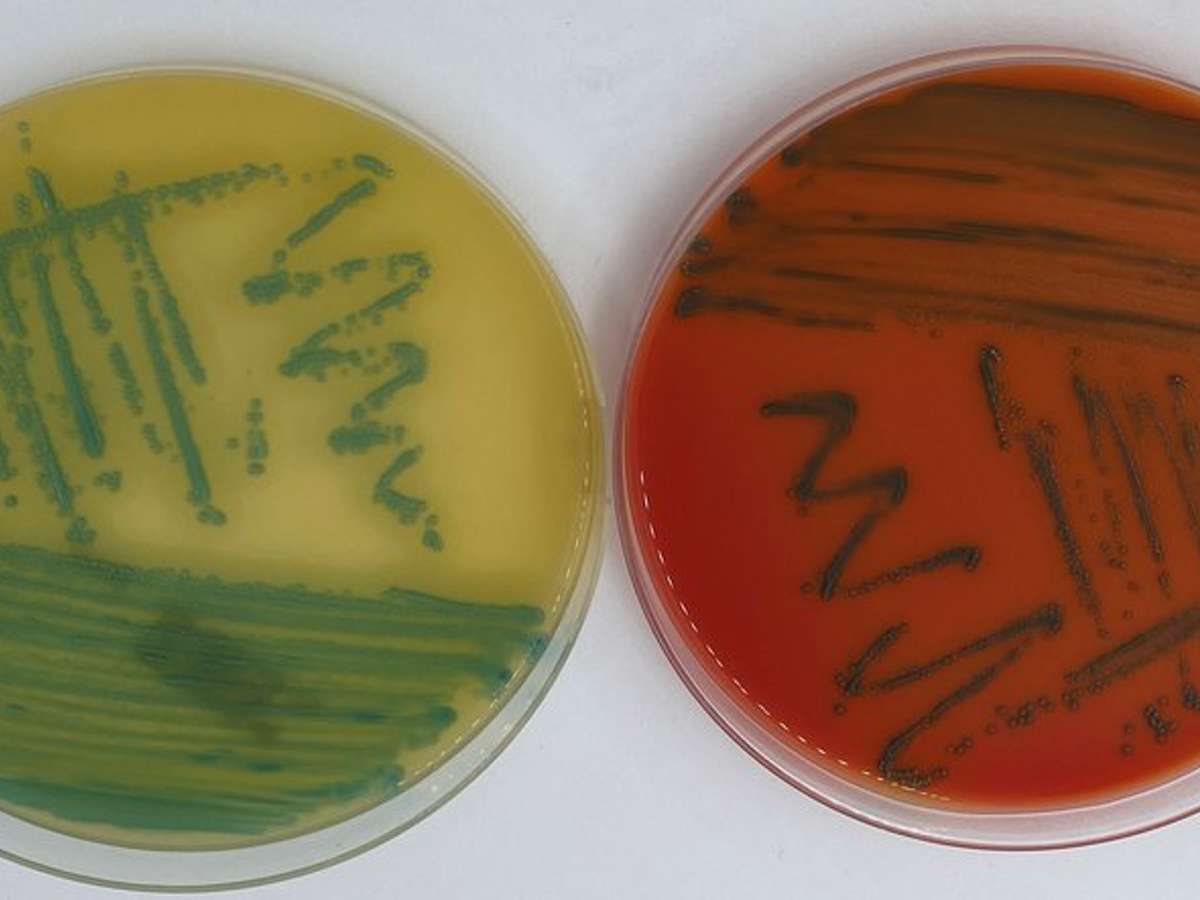 Listeria IMG 6769 Bred Foto Svanevik HI
